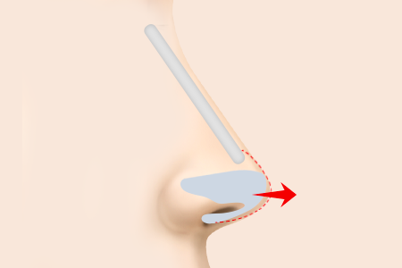 콧등 라인부터 코끝을 연결하여 다시 디자인